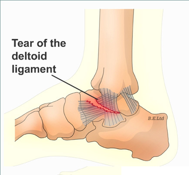 tibionavicular ligament