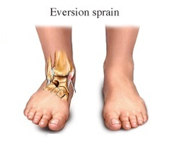 Eversion Of Ankle